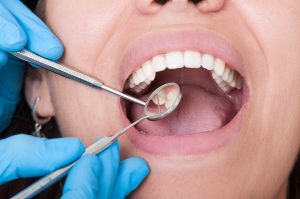 General Dentistry Services at Rye Family Dental Care